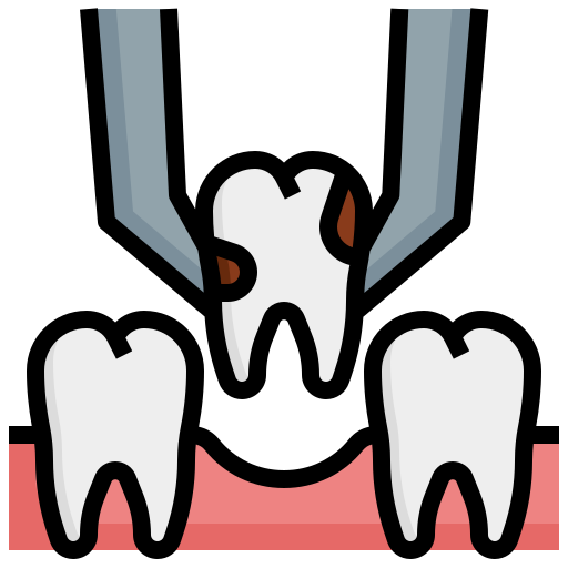 Tooth Extraction